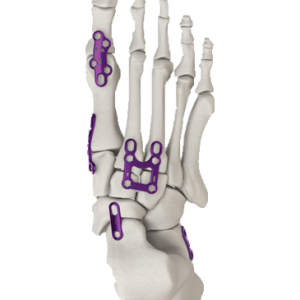 Gorilla-Foot-image